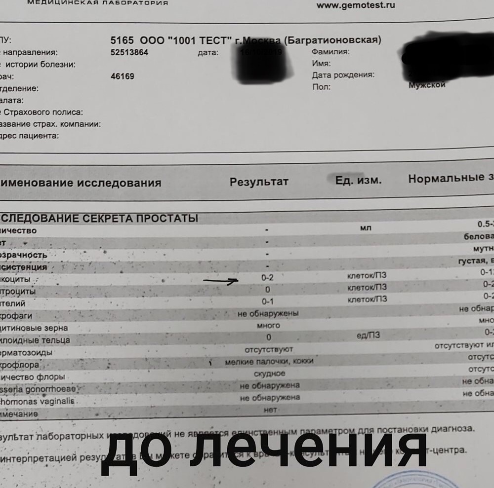 исследование секрета простаты Анализы